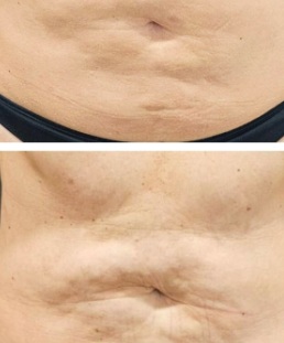 Testimonio RenaceSalud 6